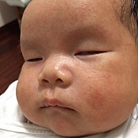 宝宝40多天 哪位宝妈知道这是什么？怎么办？