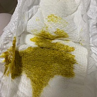 一个半月宝宝拉黄色水状的大便怎么回事？