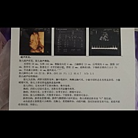 有没有看懂四维的能看出男宝女宝吗，第一胎男宝女宝都喜欢，就是有点好奇😂😂