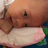 有没有什么方法治疗脸上的疙瘩……只有脸上有，医生说不多就不用药……