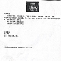 六周的b超照片，能看出来男宝女宝么？