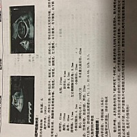 听说四维可以看出宝宝性别，大家猜猜看男宝女宝，太好奇了