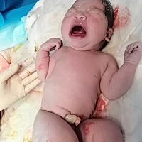 报喜了，孕期检查做B超，宝宝都比较小，预估五斤多点点，没想到出来3390g￼￼， 整个过程简直太酸爽