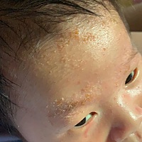 有没有宝妈知道这长的是什么的？需要注意些什么？去医院，医生说正常