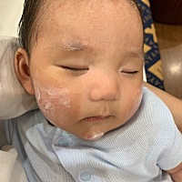 宝宝湿疹，好不容易等到黄疸退了，结果头上又长了奶痂，现在又有湿疹，宝宝成长的每一个阶段都像升级打怪呀