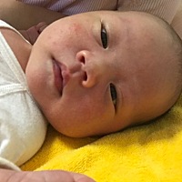 宝宝脸上突然起了红点，昨天开始起的，今天又变多了一点，请问谁知道这是什么？