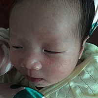 问问大家我宝宝这脸上的是什么，越来越多了