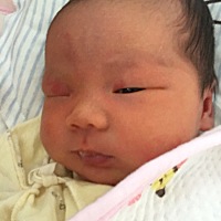 求有经验的宝妈帮我看看这是胎记还是……好害怕