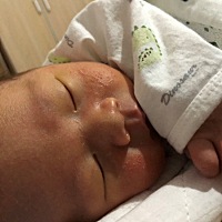 出生10天了，宝宝脸上这是长的什么啊感觉越来越多