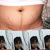 刨妇产两个月，伤口还有点红痒，看别人生了好像没生一样，看到自己都不开心，肚子已经花了，孕前103斤现...