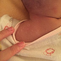 宝妈们 谁知道宝宝后背长的白点点是怎么回事呢？