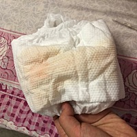 求助，宝宝6个月，最近尿尿出现粉红色，然后尿尿变少。不发烧也不恶吐也不哭闹，有亲们出现过这个情况吗？