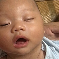 请问一下有没有宝宝有这样的情况。额头上有点白斑