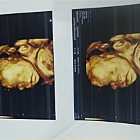 昨天做四维了，宝宝照的不是很清楚，还没三分钟就做好了，感觉没有别人做的思维数据详细，大家帮我看下...