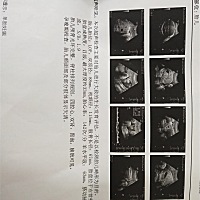 家有一儿一女，现在三胎36周＋2天。也不知道是男是女。有B超结果一样的吗？