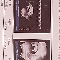 二年了终于怀孕了
