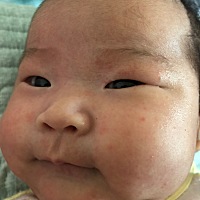 宝宝一个月零八天，求各位家长谁知道这是湿疹，还是热痱子，还是什么原因呢？ 一位心里着急的妈妈