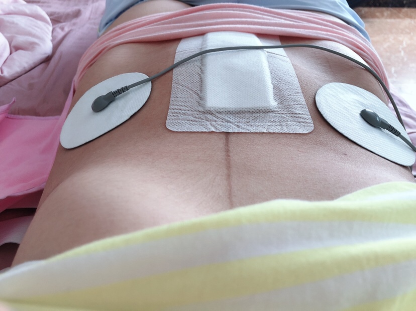 每天做理疗有助子宫恢复