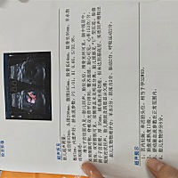 都说头大腿短是男孩，头小腿长是女孩。我宝一直都是头小腿长，而且都说女孩像爸爸，三维照片也特别像我...