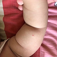 各位宝妈！帮我看下我家宝宝怎么了？身上脸上起的小红点，平的，不鼓包，就是小红点，这是怎么回事阿。