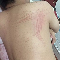 大家看看 这种抓痕是不是出轨了 老公出差半个月回家 说自己也不知道怎么回事 说没碰着 也不是猫抓 ...