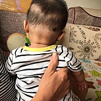 我家宝宝头一直往右歪怎么办？才5个月