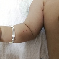 宝宝身上长了几个红点，请问有宝妈知道这是啥原因吗？