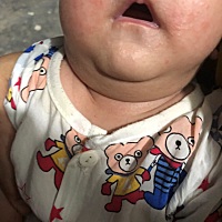 这是湿疹吗，基本都在空调房里，怎么还这样。。大家有推荐的抹什么药吗，还有有人ad滴剂吃3.4粒的吗，医...