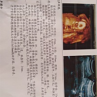 宝妈们有看懂的吗？