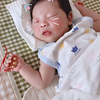 今天第17天了 眼睛上和额头上还是红红的 都说生的时候挤的 大概多久能下去