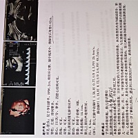 24周多的三维彩超，宝宝长的怎么样呢？脸的旁边是腿吗？眼睛处有点怪怪的？