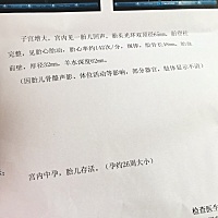 有没有会看的宝妈或者差不多一样的.只想儿女双全不想痛三次！