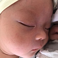 宝宝的脖子都烂掉了，请问宝妈们都用什么啊