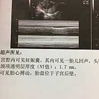 有没有朋友会看的呀，二胎宝宝看有没有幸可以儿女双全呀......谢谢！纯属好奇呀