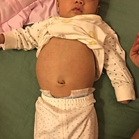 为什么宝宝肚子总是圆鼓鼓的呢？宝妈们有知道的吗