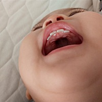 宝宝一岁了，牙根部长了这样类似牙的东西是什么啊？用上医院么？