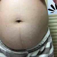 报喜了  报喜了，B超单双肾分离不一定都是男宝，我生下来就是女孩子，预产期过4天，6斤6两，生时挺...