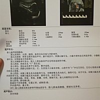 头胎，好奇给宝贝买粉裙裙还是蓝背心～求有经验者看一下～