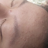 怀孕初期(1-3个月):    吃什么吐什么，还感冒发烧，每天靠着一点牛奶吊着仙命！ 怀孕中期(4-6个月):   ...