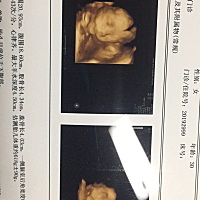 倒计时100天，是佩奇吗？