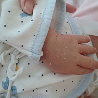 宝宝手脚都在脱皮，这是正常的吗？宝妈们有知道的吗？