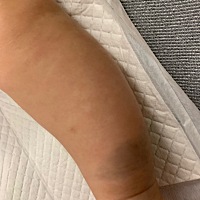 请问这个青色的是什么？以后大了会退了吗？