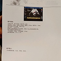 有经验的宝妈们麻烦帮忙看一下是乔治还是佩奇？谢谢😘