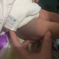 问一下大家，宝宝大腿上的青色的会消失吗？