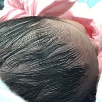 终于在8月3日顺产侧切了六斤7两的小闺女，这滋味简直了