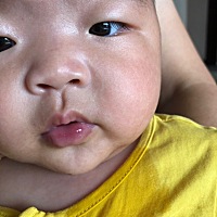 宝贝四个多月了，突然下嘴唇中间发紫，看到网上说的有可能是心脏的问题，吓都吓死了，不知道是不是真的...