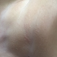 宝妈们，宝宝颈上长这个是什么东东呀