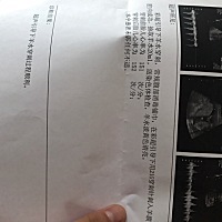 今天做了羊水穿刺！ 很疼！！！医生够狠！！！ 希望3个礼拜后是好的结果等着我😊 粑粑麻麻爱你❤你也...