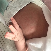 昨天下雨，天气不是很热，晚上空调调到29度，身上盖了两层纱的浴巾，今天早上起床发现宝宝全身都是红色...