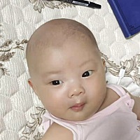 脑门被自己挠坏了，，现在8斤半了……这个月争取突破10斤